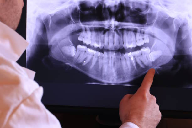 Best Knocked-Out Tooth Emergency  in Laflin, PA